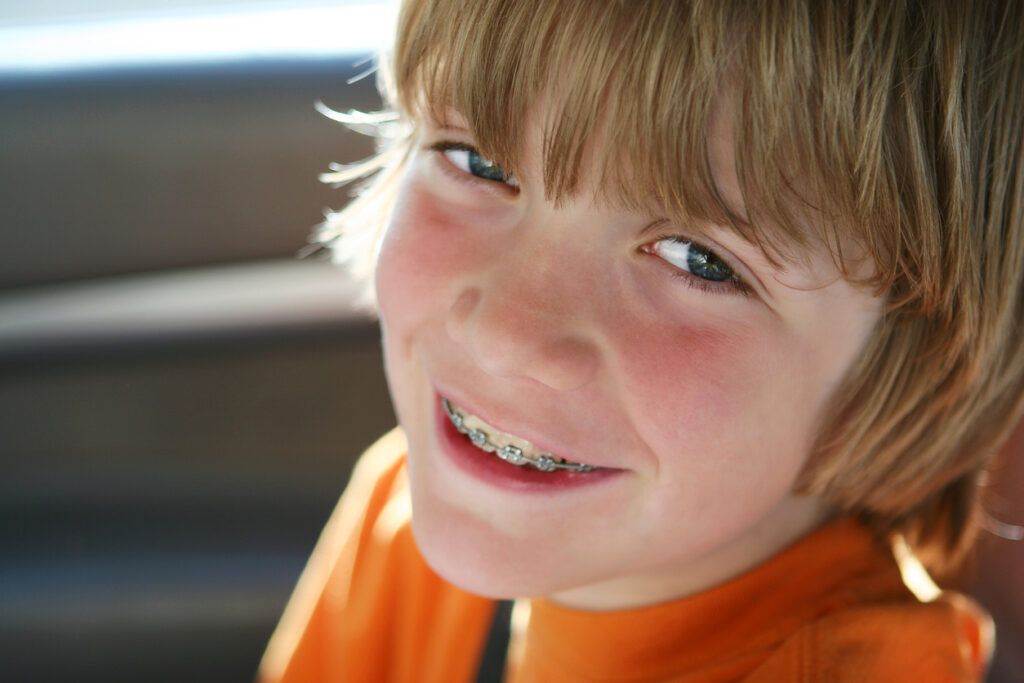 Close up Portrait of boy with braces back lit from the summer sun. Shallow depth of field, focus on his eye.