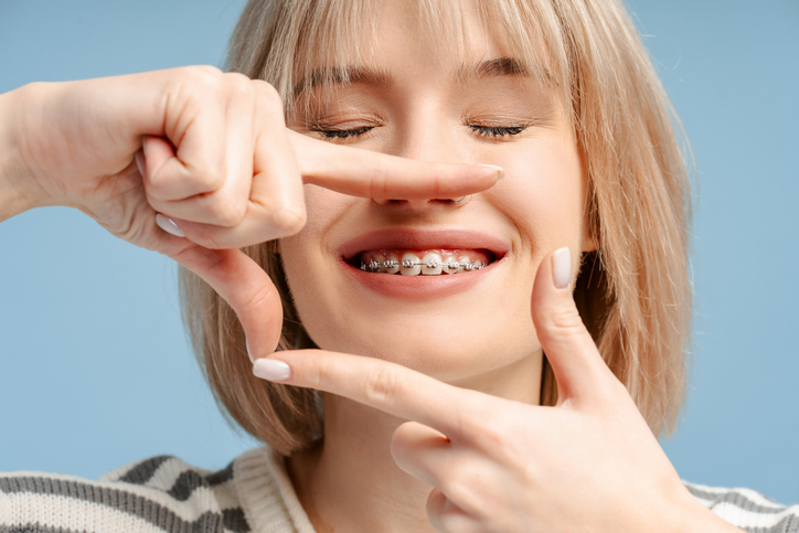 Close up of a teen with braces framing her smile with her fingers